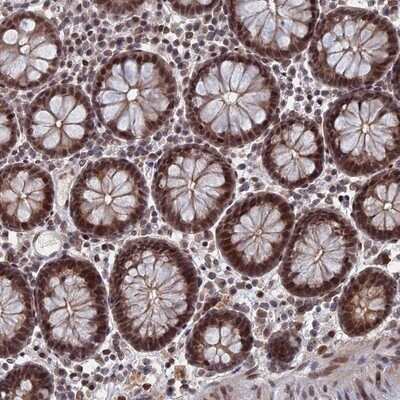 Immunohistochemistry-Paraffin: TRA16 Antibody [NBP1-92526] - Staining of human colon shows moderate nuclear positivity in glandular cells.