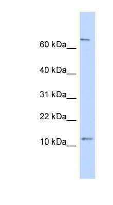 Western Blot: TRA16 Antibody [NBP1-56746] - Human Heart lysate, concentration 0.2-1 ug/ml.