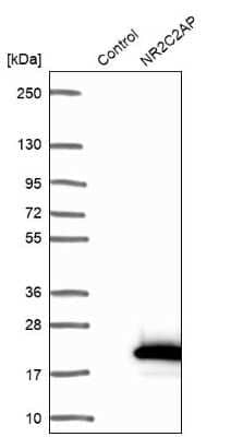 Western Blot: TRA16 Antibody [NBP1-92526] - Analysis in control (vector only transfected HEK293T lysate) and NR2C2AP over-expression lysate (Co-expressed with a C-terminal myc-DDK tag (3.1 kDa) in mammalian HEK293T cells).