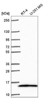 Western Blot: TRA16 Antibody [NBP2-55864] - Western blot analysis in human cell line RT-4 and human cell line U-251 MG.