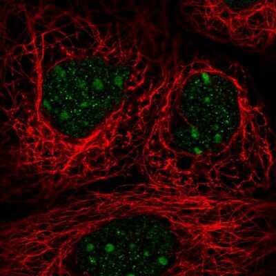Immunocytochemistry/ Immunofluorescence TRA2A Antibody - BSA Free