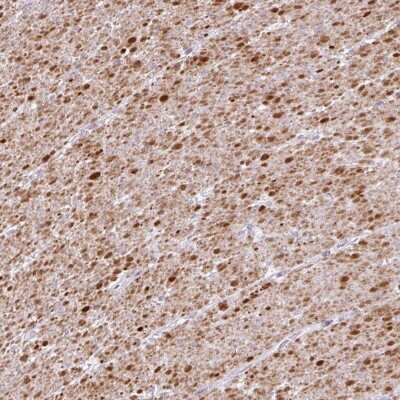 Immunohistochemistry-Paraffin: TRA2A Antibody [NBP2-13473] - Staining of human smooth muscle shows cytoplasmic positivity in smooth muscle cells.