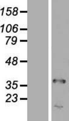 Western Blot: TRA2A Overexpression Lysate (Adult Normal) [NBL1-17237] Left-Empty vector transfected control cell lysate (HEK293 cell lysate); Right -Over-expression Lysate for TRA2A.