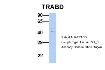 Western Blot: TRABD Antibody [NBP2-86870] - Host: Rabbit. Target Name: TRABD. Sample Type: 721_B. Antibody Dilution: 1.0ug/mlTRABD is supported by BioGPS gene expression data to be expressed in 721_B