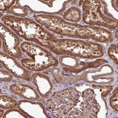 Immunohistochemistry-Paraffin: TRABD2B Antibody [NBP2-14558] Staining of human kidney shows strong cytoplasmic positivity in cells in tubules.