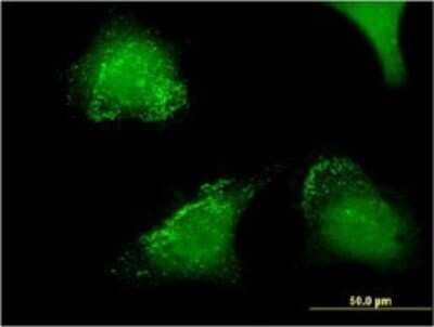 Immunocytochemistry/Immunofluorescence: TRACP/PAP/ACP5 Antibody (2D9) [H00000054-M01] - Analysis of monoclonal antibody to ACP5 on HeLa cell . Antibody concentration 10 ug/ml.