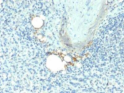 Immunohistochemistry-Paraffin: TRACP/PAP/ACP5 Antibody (ACP5/1070) - Azide and BSA Free [NBP2-47666] - Formalin-fixed, paraffin-embedded human Spleen stained with TRACP/PAP/ACP5 Antibody (ACP5/1070).