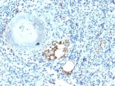 Immunohistochemistry-Paraffin: TRACP/PAP/ACP5 Antibody (ACP5/2336R) - Azide and BSA Free [NBP3-08700] - Formalin-fixed, paraffin-embedded human Spleen stained with TRACP/PAP/ACP5 Rabbit Recombinant Monoclonal Antibody (ACP5/2336R).