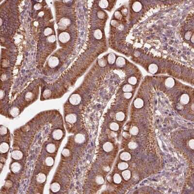 Immunohistochemistry: TRADD Antibody [NBP2-68918] - Immunohistochemical staining of human duodenum shows strong cytoplasmic positivity in glandular cells.