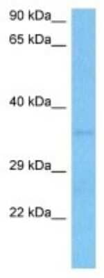 Western Blot: TRADD Antibody [NBP3-10094] - Western blot analysis of TRADD in Human HepG2 Whole Cell lysates. Antibody dilution at 1ug/ml