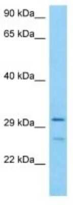 Western Blot: TRADD Antibody [NBP3-10118] - Western blot analysis of TRADD in Human HT1080 Whole Cell lysates. Antibody dilution at 1ug/ml