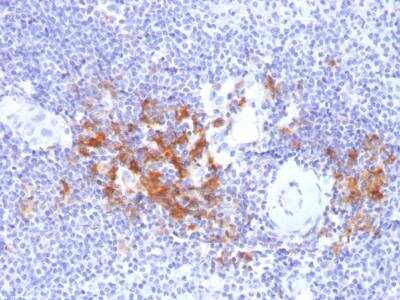 Immunohistochemistry-Paraffin: TRAF-1 Antibody (TRAF1/2770) - Azide and BSA Free [NBP2-79924] - Formalin-fixed, paraffin-embedded human Spleen stained with TRAF1 Mouse Monoclonal Antibody (TRAF1/2770).