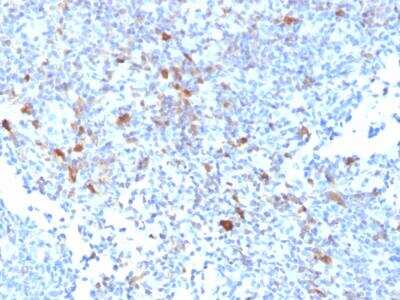 Immunohistochemistry-Paraffin: TRAF-1 Antibody (TRAF1/2770) - Azide and BSA Free [NBP2-79924] - Formalin-fixed, paraffin-embedded human Lymph Node stained with TRAF1 Mouse Monoclonal Antibody (TRAF1/2770).
