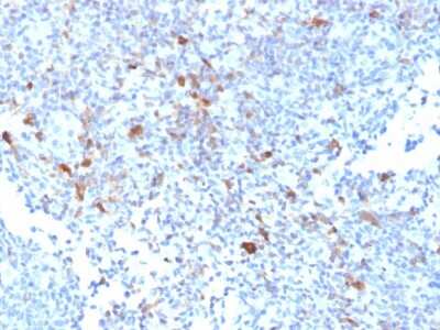 Immunohistochemistry-Paraffin: TRAF-1 Antibody (TRAF1/2770) [NBP2-79790] - Formalin-fixed, paraffin-embedded human Lymph Node stained with TRAF-1 Antibody (TRAF1/2770).