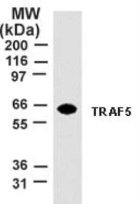 Western Blot: TRAF-5 Antibody (55A219) - Azide and BSA Free [NBP2-80988] - Analysis of TRAF-5 using this antibody at 2 ug/ml dilution against 10 ug of HeLa cell lysate. Image from the standard format of this antibody.