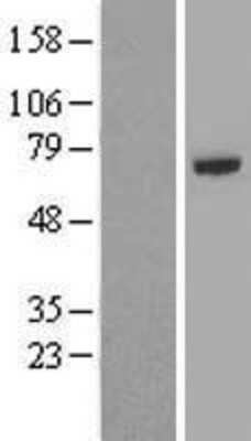 Western Blot: TRAF5 Overexpression Lysate (Adult Normal) [NBP2-08629] Left-Empty vector transfected control cell lysate (HEK293 cell lysate); Right -Over-expression Lysate for TRAF5.