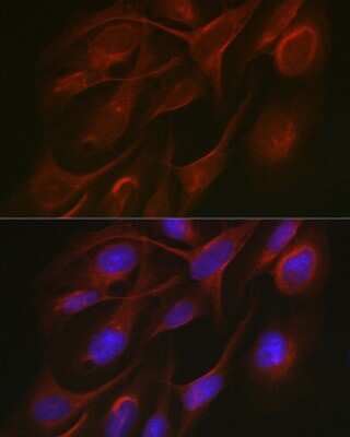 Immunocytochemistry/Immunofluorescence: TRAF7 Antibody [NBP3-04330] - Immunofluorescence analysis of U2OS cells using TRAF7 antibody (NBP3-04330) at dilution of 1:50. Blue: DAPI for nuclear staining.