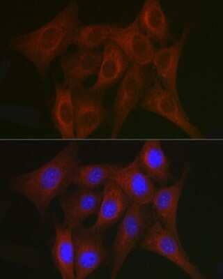 Immunocytochemistry/Immunofluorescence: TRAF7 Antibody [NBP3-04330] - Immunofluorescence analysis of NIH/3T3 cells using TRAF7 antibody (NBP3-04330) at dilution of 1:50. Blue: DAPI for nuclear staining.