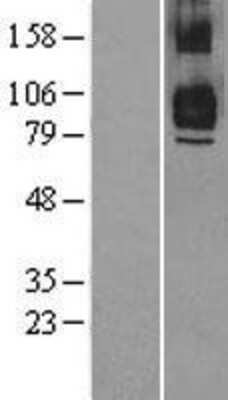 Western Blot: TRAF7 Overexpression Lysate (Adult Normal) [NBL1-17248] Left-Empty vector transfected control cell lysate (HEK293 cell lysate); Right -Over-expression Lysate for TRAF7.