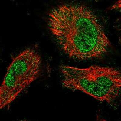 Immunocytochemistry/Immunofluorescence: TRAFD1 Antibody [NBP1-81875] - Staining of human cell line U-251 MG shows localization to nucleoplasm and cytosol.