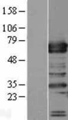 Western Blot: TRAFD1 Overexpression Lysate (Adult Normal) [NBL1-17249] Left-Empty vector transfected control cell lysate (HEK293 cell lysate); Right -Over-expression Lysate for TRAFD1.