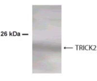 Western Blot: TRAIL R2/TNFRSF10B Antibody [NBP2-24388] - Analysis at 1:500 dilution on 50 ug of transfected 293 T cells.