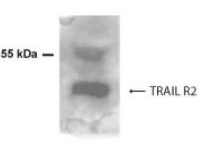 Western Blot: TRAIL R2/TNFRSF10B Antibody [NBP2-24403]