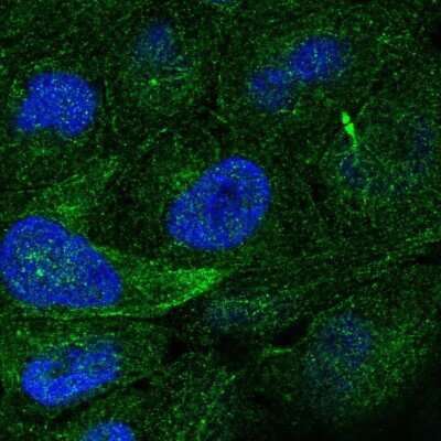 Immunocytochemistry/Immunofluorescence: TRAIL/TNFSF10 Antibody [NBP2-38744] - Immunofluorescent staining of human cell line RT4 shows localization to microtubules & cytokinetic bridge. Antibody staining is shown in green.