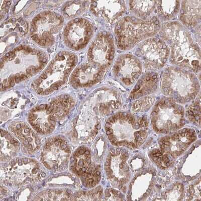 Immunohistochemistry-Paraffin: TRAIL/TNFSF10 Antibody [NBP2-38744] - Staining of human Kidney shows moderate membranous and cytoplasmic positivity in cells in tubules.