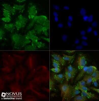 Immunocytochemistry/Immunofluorescence: TRAILR2/TNFRSF10B Antibody - Azide Free [NB100-55744] - HepG2 cells were fixed for 10 minutes using 10% formalin and then permeabilized for 5 minutes using 1X TBS + 0.5% Triton-X100. The cells were incubated with anti-TRAIL R2 (H76) at 5ug/ml overnight at 4C and detected with an anti-rabbit Dylight 488 (Green) at a 1:500 dilution. Alpha tubulin (DM1A) NB100-690 was used as a co-stain at a 1:1000 dilution and detected with an anti-mouse Dylight 550 (Red) at a 1:500 dilution. Nuclei were counterstained with DAPI (Blue). Cells were imaged using a 40X objective. Image using the standard format of this product.