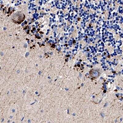 Immunohistochemistry-Paraffin: TRAILR2/TNFRSF10B Antibody - Azide Free [NB100-55744] - Analysis of a formalin fixed paraffin-embedded (FFPE) human brain cerebellum using 1:200 conc. of TRAIL R2/TNFRSF10B antibody on a Bond Rx autostainer (Leica Biosystems). The assay involved 30 minutes of heat induced antigen retrieval (HIER) using 10mM sodium citrate buffer (pH 9.0) and endogenous peroxidase quenching with peroxide block. The sections were incubated with primary antibody for 15 minutes and Bond Polymer Refine Detection (Leica Biosystems) with DAB was used for signal development followed by counterstaining with hematoxylin. Cytoplasmic staining was observed in the Purkinje cell layer. Image using the standard format of this product.