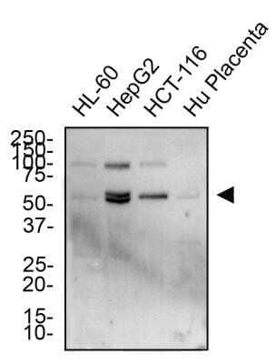 Western Blot: TRAILR2/TNFRSF10B Antibody - Azide Free [NB100-55744] - Total protein from HL-60, HepG2, HCT-116 and human placenta was separated on a 12% gel by SDS-PAGE, transferred to PVDF membrane and blocked in 5% non-fat milk in TBST. The membrane was probed with 2.0 ug/ml anti-TRAIL R2 in 1% non-fat milk in TBST and detected with an anti-rabbit HRP secondary antibody using chemiluminescence. Image using the standard format of this product.