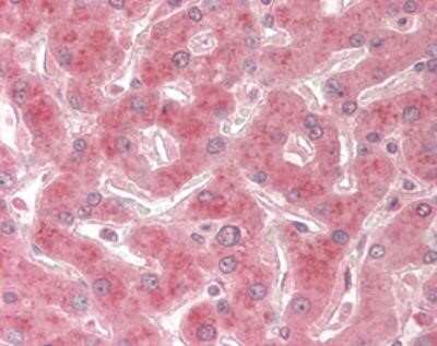 Immunohistochemistry: TRAILR2/TNFRSF10B Antibody (HS201) - Azide and BSA Free [NBP2-80067] - Staining of TRAIL-R2 using anti-TRAIL-R2 (human), mAb (HS201) in human liver tissue (15 ug/mL).