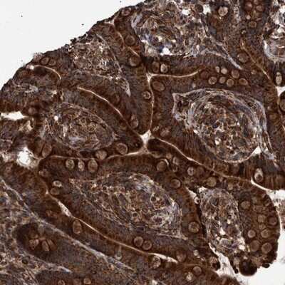 Immunohistochemistry-Paraffin: TRAILR2/TNFRSF10B Antibody [NBP1-85772] - Staining of human colon shows strong cytoplasmic positivity in glandular cells.