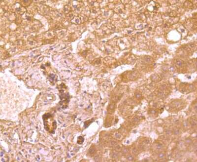 Immunohistochemistry-Paraffin: TRAILR2/TNFRSF10B Antibody (JA03-38) [NBP2-67225] - Analysis of paraffin-embedded human liver tissue using anti-DR5 antibody. Counter stained with hematoxylin.