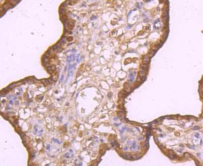 Immunohistochemistry-Paraffin: TRAILR2/TNFRSF10B Antibody (JA03-38) [NBP2-67225] - Analysis of paraffin-embedded human placenta tissue using anti-DR5 antibody. Counter stained with hematoxylin.