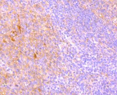 Immunohistochemistry-Paraffin: TRAILR2/TNFRSF10B Antibody (JA03-38) [NBP2-67225] - Analysis of paraffin-embedded human tonsil tissue using anti-DR5 antibody. Counter stained with hematoxylin.