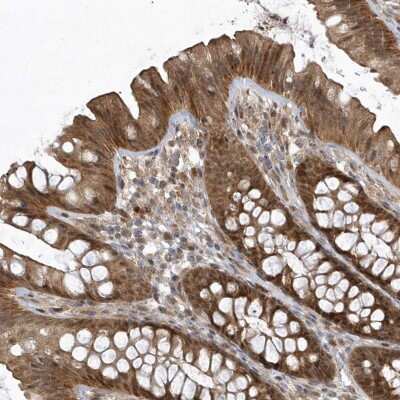 Immunohistochemistry: TRAIP Antibody [NBP2-48655] - Staining of human colon shows strong cytoplasmic and nuclear positivity in glandular cells.