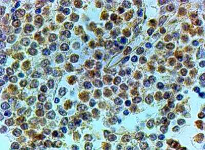 Immunohistochemistry-Paraffin: TRAIP Antibody [NB100-1230] - Human Spleen. Steamed antigen retrieval with citrate buffer pH 6, HRP-staining.