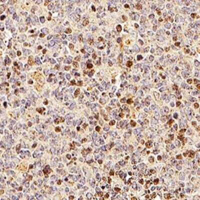 Immunohistochemistry-Paraffin: TRAIP Antibody - Unpurified [NB100-56180] - TRAIP was detected in immersion fixed paraffin-embedded sections of human tonsil using this antibody at 1:1000 for 1 hour at room temperature followed by incubation with the Anti-Rabbit IgG VisUCyte™ HRP Polymer Antibody (Catalog # VC003). Tissue was stained using DAB (brown) and counterstained with hematoxylin (blue). Nuclear staining was observed in lymphocytes.