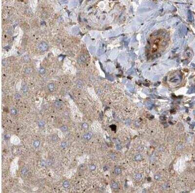 Immunohistochemistry-Paraffin TRAIP Antibody