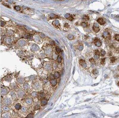 Immunohistochemistry-Paraffin TRAIP Antibody