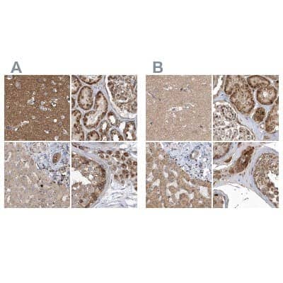 Immunohistochemistry-Paraffin: TRAIP Antibody [NBP1-87125] - Staining of human cerebral cortex, kidney, liver and testis using Anti-TRAIP antibody NBP1-87125 (A) shows similar protein distribution across tissues to independent antibody NBP2-48655 (B).