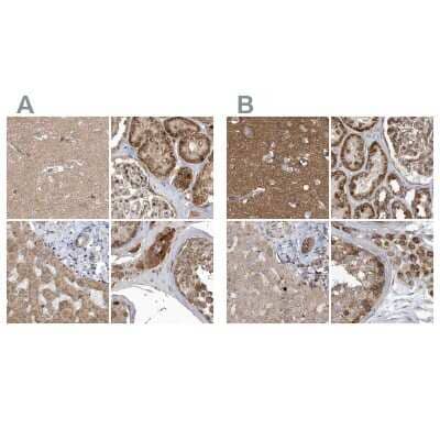 <b>Independent Antibodies Validation. </b>Immunohistochemistry-Paraffin: TRAIP Antibody [NBP2-48655] - Staining of human cerebral cortex, kidney, liver and testis using Anti-TRAIP antibody NBP2-48655 (A) shows similar protein distribution across tissues to independent antibody NBP1-87125 (B).