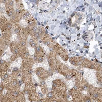 Immunohistochemistry-Paraffin: TRAIP Antibody [NBP2-48655] - Staining of human liver.