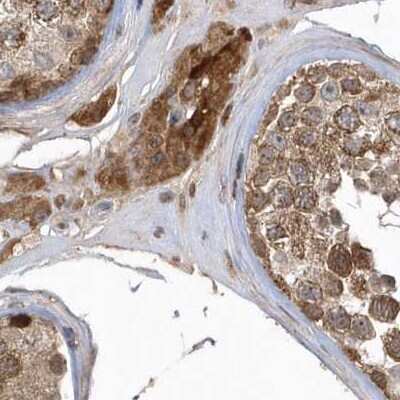 Immunohistochemistry-Paraffin: TRAIP Antibody [NBP2-48655] - Staining of human testis.