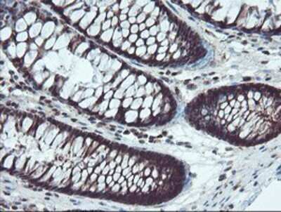 Immunohistochemistry: TRAIP Antibody (OTI2D4) - Azide and BSA Free [NBP2-74580] - Staining of paraffin-embedded Human colon tissue using anti-TRAIP mouse monoclonal antibody.