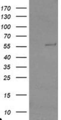 Western Blot: TRAIP Antibody (OTI2D4) - Azide and BSA Free [NBP2-74580] - HEK293T cells were transfected with the pCMV6-ENTRY control (Left lane) or pCMV6-ENTRY TRAIP (Right lane) cDNA for 48 hrs and lysed. Equivalent amounts of cell lysates (5 ug per lane) were separated by SDS-PAGE and immunoblotted with anti-TRAIP.