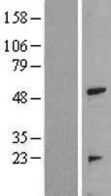 Western Blot: TRAIP Overexpression Lysate (Adult Normal) [NBL1-17250] Left-Empty vector transfected control cell lysate (HEK293 cell lysate); Right -Over-expression Lysate for TRAIP.