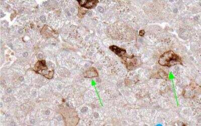 Immunohistochemistry-Paraffin: TRANCE/TNFSF11/RANK L Antibody (12A668) - Azide Free [NB100-56593] - Formalin-fixed, paraffin-embedded human liver stained with Trance antibody (1:500, 1 ug/ml), peroxidase-conjugate and DAB chromogen.  A 2 hr incubation at RT was used.